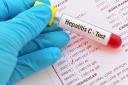 Your GP may recommend having a blood test that can check for hepatitis C