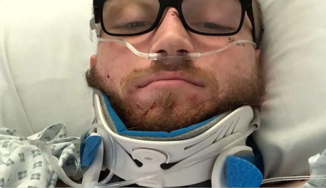 Ambleside chef will never walk again after horror motorbike crash - Vimarsana News